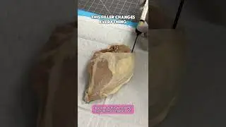 This Filler Changes Everything (Alloclae Demo) | Dr. Matthew J. Nykiel