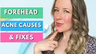 Pimples on forehead meaning - FOREHEAD ACNE TREATMENT!