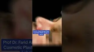 Rhinoplasty in Pakistan Lahore by Dr. Fareed | cosmetic surgery institute & clinic