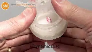 Endplate disruption using a Dynamic Disc Model