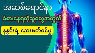အဆစ်ရောင်နာ ခံစားနေရသူတွေအတွက် နနွင်းရဲ့ ဆေးဖက်ဝင်မှု