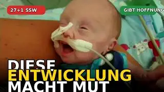 Die Geschichte Von Unserem Extrem Fr&uuml;hchen Leon