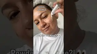 Centellian24 AC tea tree and madeca cream #madecacream #teatree #acne #kbeauty #centellian24 #glow