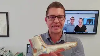 Fixing Foot Pain Without Orthotics