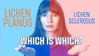 Lichen Sclerosus and lichen planus: what's the difference?