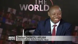 High Prevalence of Prostate Cancer in Nigerian Men -Aruah