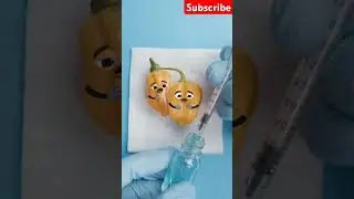 Paprika Foodsurgery ENDS TRAGIC😭💔-CONJOINED TWINS Separation #fruitsurgery #shorts #baby