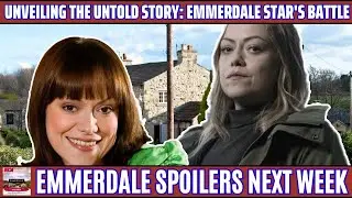 Emmerdale: Unveiling the Untold Story: Emmerdale Star's Battle with Soap Fans | #emmerdale