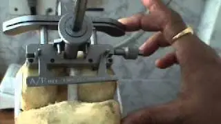 Knee Replacement Surgery Demo by Dr.Milind Patil, India