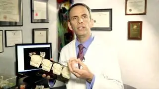 How Tooth Loss and Bone Loss Lead To Large Facial Changes