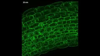 Enhanced Arabidopsis Live Cell Imaging Obtained Through Affordable and Efficient Heating Devices
