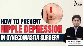 How to Prevent Nipple Depression in Gynecomastia Surgery?