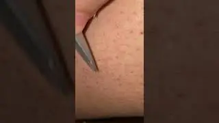 Leg hair removal #leghair #hairremoval #pubgmobile #pluckingwhitehair  #pluck