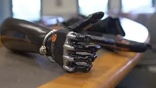 WPI Professor Teaming with Experts to Develop Wireless Sensors for New Prosthetics Device