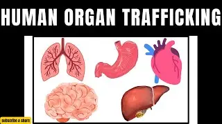 Organ trafficking in Pakistan | Human Organ trafficking in India | human organs | real organs human