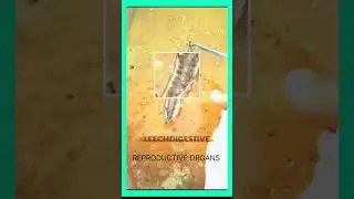 LEECH.. Digestive and Reproductive orange.