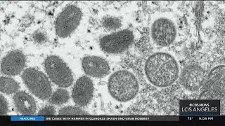 Health officials address rising monkeypox cases in LA County