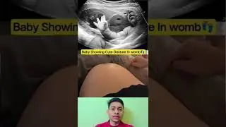 Baby Showing Reaction In The Womb&hearts;️ | Nursing Educational video #babycare​ #pregnancy​ #shortsfeed