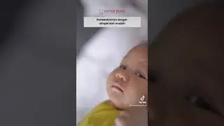 Sunat Bayi Modern Gresik On Hotel Exclusive | rumahsunatgresik.com