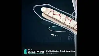 ANDROLOJİ, EREKSİYON NASIL GER&Ccedil;EKLEŞİR.  DO&Ccedil; DR SERDAR AYKAN