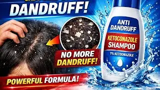 👉 Ketoconazole Anti-Dandruff Shampoo | डैंड्रफ का पक्का इलाज? | Hindi