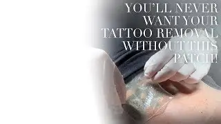 You'll Never Want Your Tattoo Removal Without This Patch!