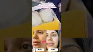 &ldquo;Real Customer Results 😍 | WhiteCherry Whitening Cream Before & After | Daily Orders Proof 💌&rdquo;