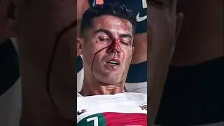 Ronaldo&rsquo;s Serious Car Accident #shorts