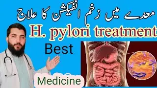 H Pylori treatment|H Pylori symptoms| Helicobacter pylori|stomach ulcers|H pylori ka ilaj in Urdu