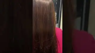 After 6 months Nanoplastia Results||