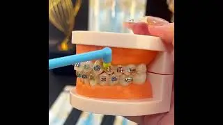 6pcs Universal Dental Care Toothbrushes&ndash;Soft Bevel Bristles, Small Head, End-Tuft for Plaque Removal