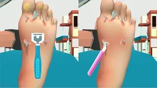 ✅ Foot clinic in All Levels Mobile Walkthrough Gameplay Trailer Update Game iOS,Android
