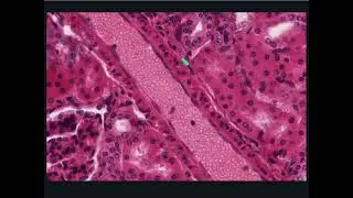 Cardiovascular Histology - Arteriole and Venule Longitudinal Section