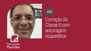 CORREÇÃO DE CLASSE II COM ANCORAGEM ESQUELÉTICA