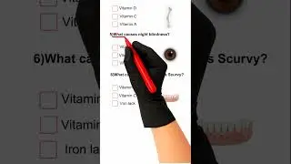 VITAMIN QUIZ || Quiz Part 213