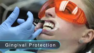 iBrite Video