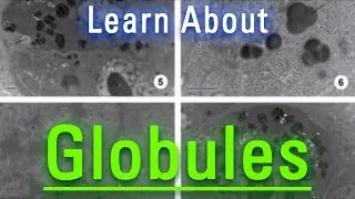 What are Globules? | How to Say Globules in English? | How Do Globules Look?
