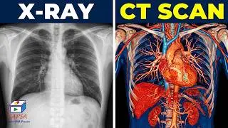 Comprehensive Guide to CT Scans: Understanding Types, Procedures, Radiation & 3D Imaging