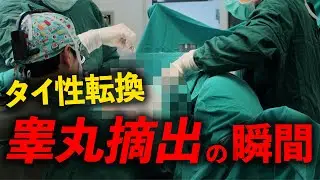 タイのローカル病院で、性別適合手術を受けた結果…。