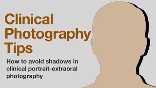 Clinical photography tips on how to avoid shadows in portrait and extraoral photography