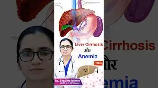 Liver cirrhosis or anemia #shorts