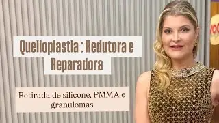 Queiloplastia Redutora e Reparadora | Cirurgia para Redução e Correção dos Lábios