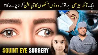 If One Eye Has Squint, Do You Need Surgery in Both Eyes?