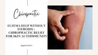 Eczema Help Without Steroids | Chiropractic Relief for Skin Autoimmunity at Gohl Clinic