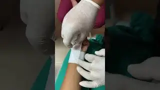 Vendaje de puño