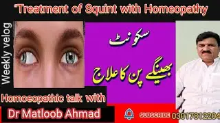 Squint بھینگا پن Dr Matloob Ahmad/Urdu Hindi انکھیں ایک زاویے میں نہ ہونا یا ڈیلے ایک طرف کو مڑ نا