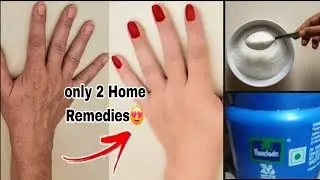 Hand care Routine at Home!💗glow and clean!most easy manicure #Viral