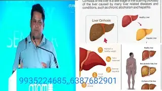 Atomy Milk Thistle,Highly effective supplement  liver Health  Liver Regrowth, testimony 9935224685