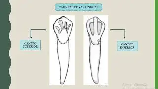 COMPARACIÓN ENTRE CANINO SUPERIOR E INFERIOR