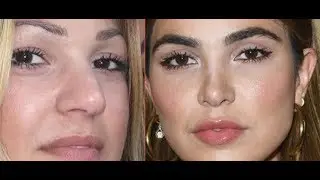 Instagram Model Negin Mirsalehi BEFORE plastic surgery real face